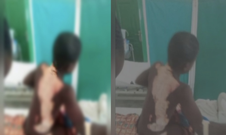 Ten-year-old boy set ablaze in Kasoa.